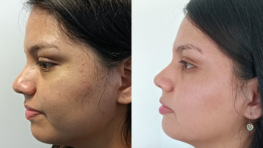 Nathaly's Shares Positive Skin Results with Seoul Kissed's REUNIÃO Cream