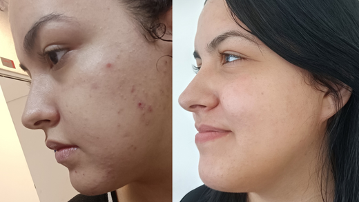 Thais F. Shares Her Exciting Journey with REUNIÃO's Face & Body Cream